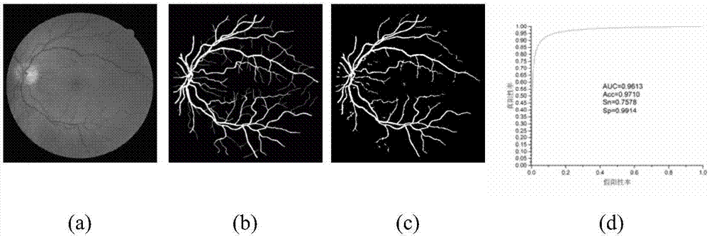 ELM-based fundus image retinal vessel segmentation method