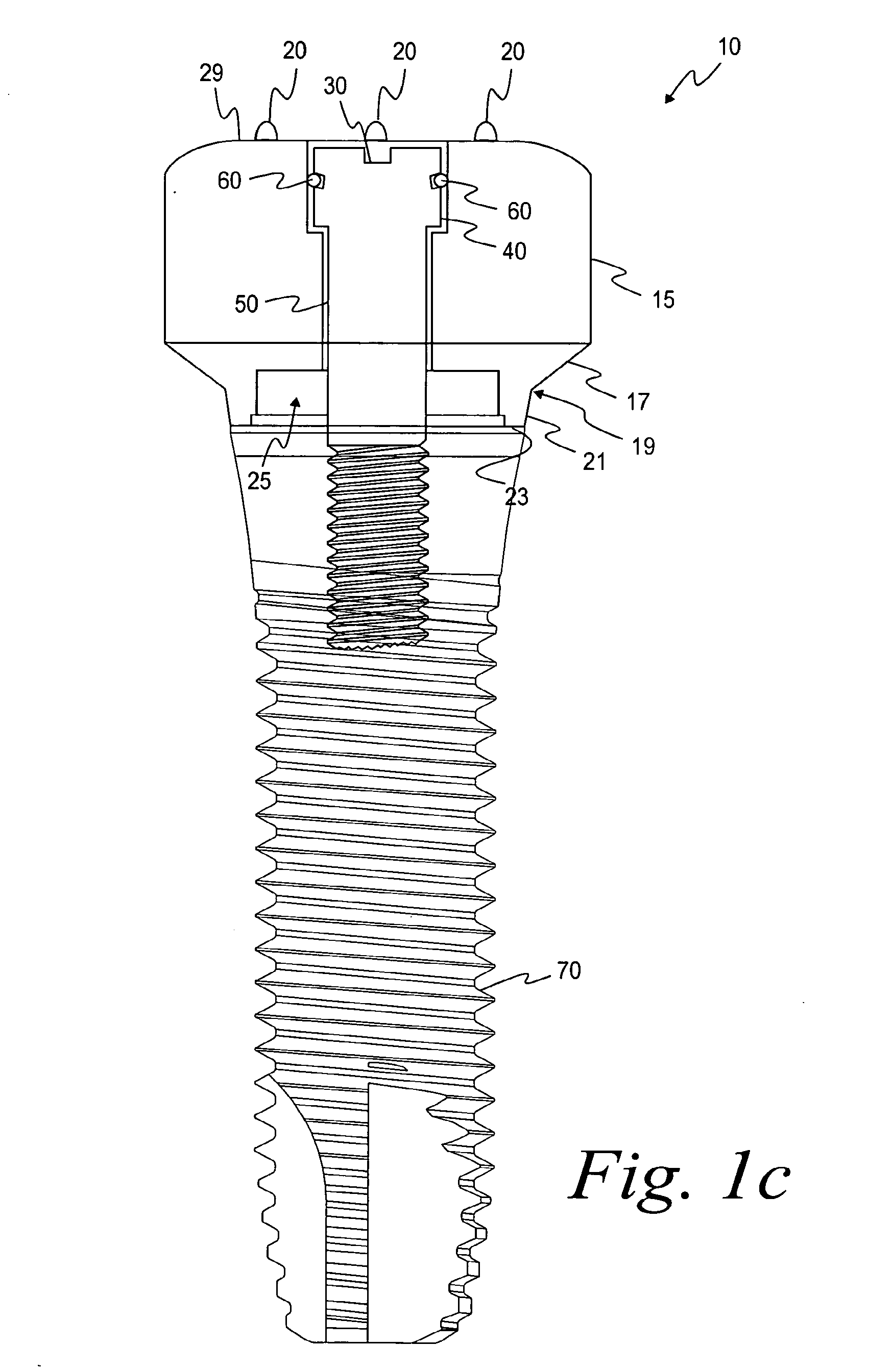 Methods For Manufacturing Dental Implant Components