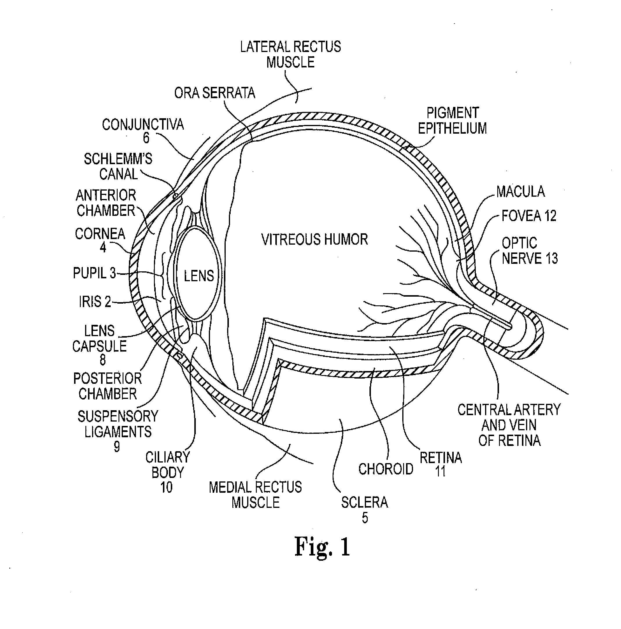 Implantable ocular drug delivery device and methods