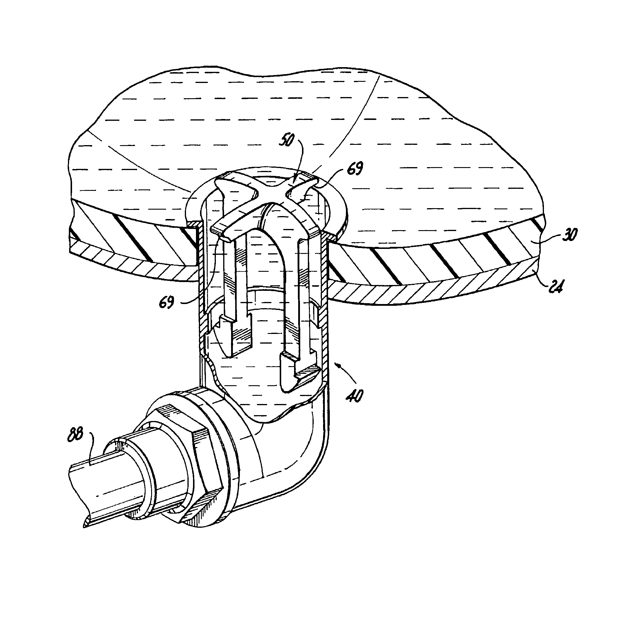 Device for causing turbulent flow in a tank assembly