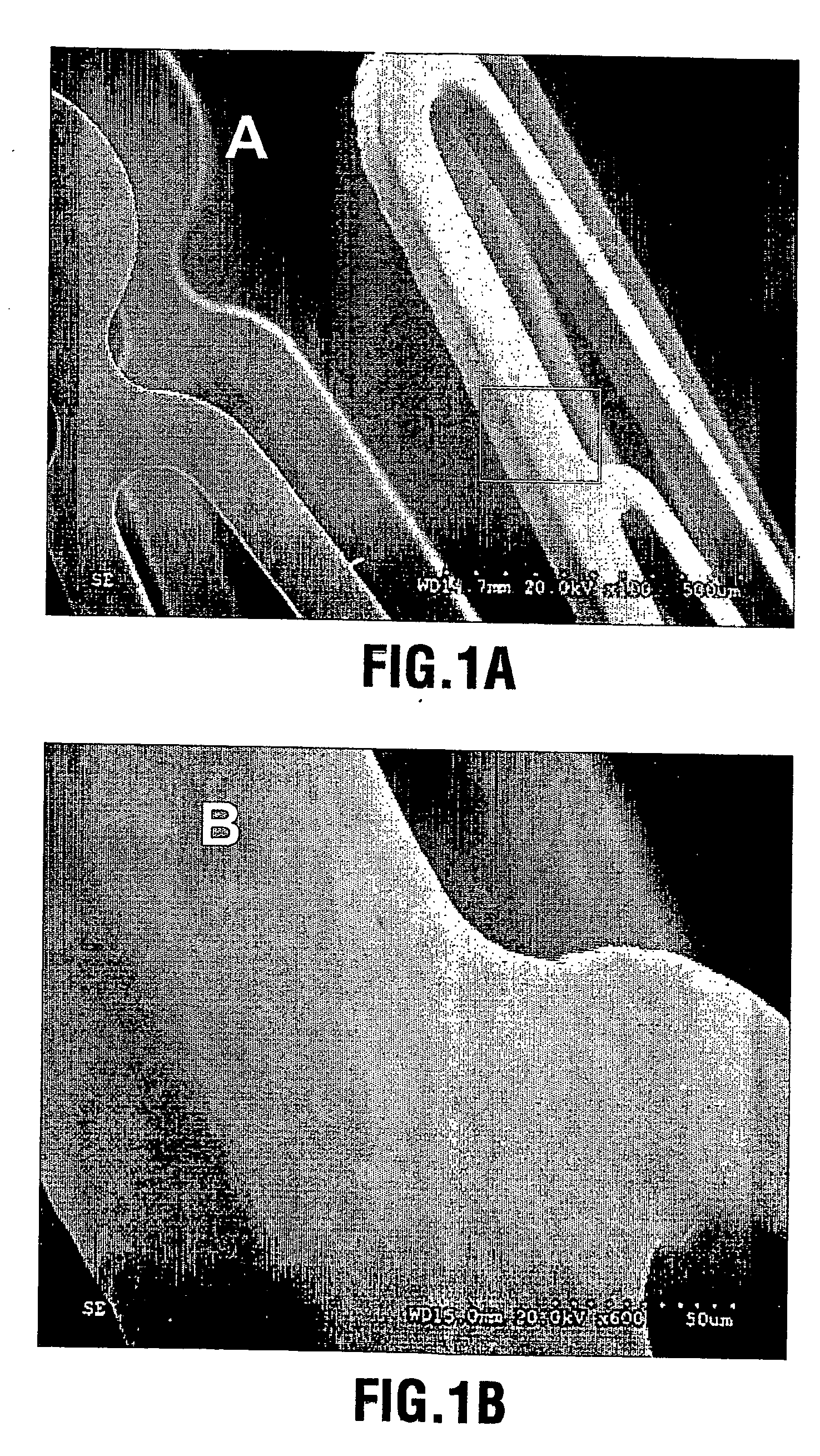 Calcium phosphate coated implantable medical devices and processes for making same