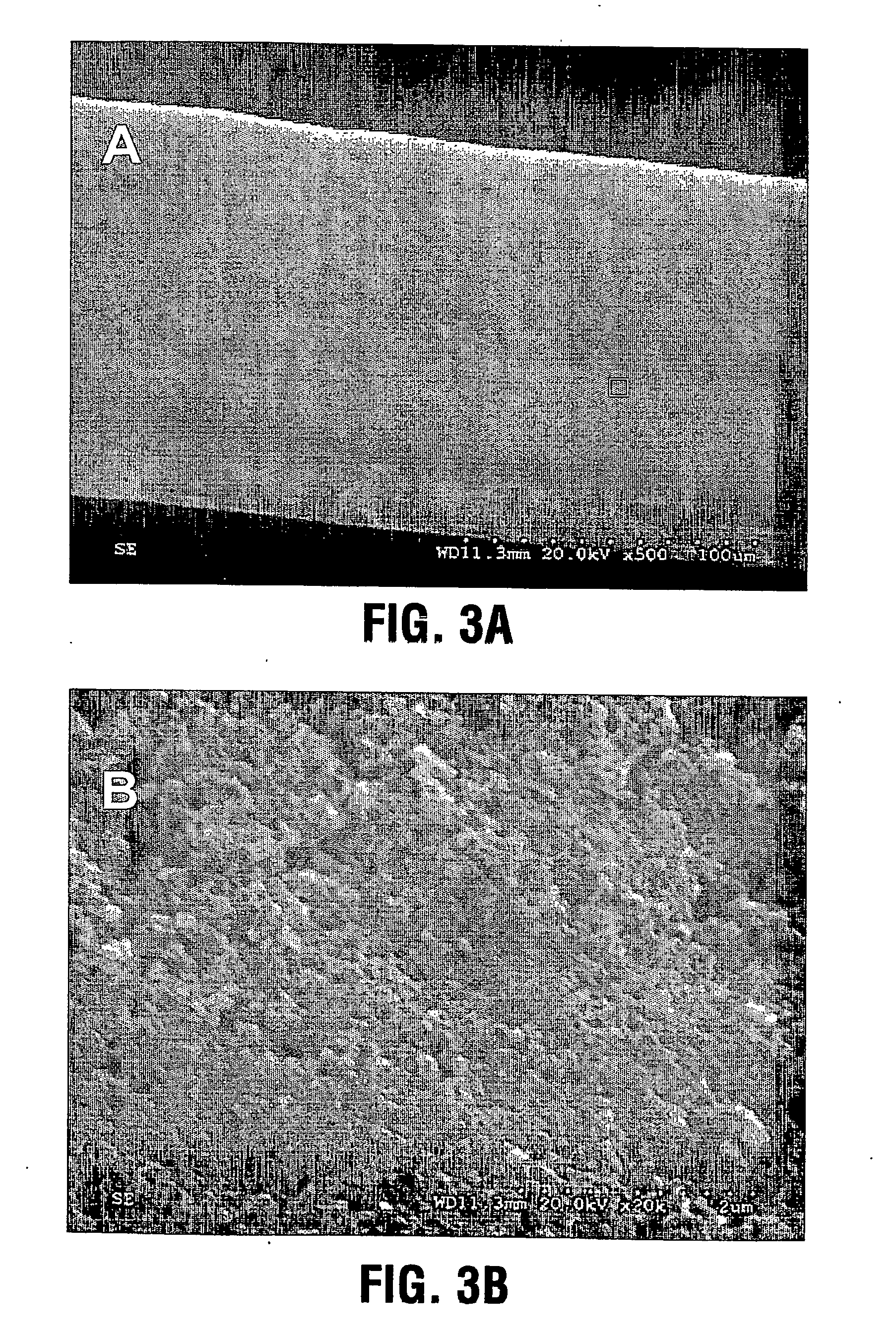 Calcium phosphate coated implantable medical devices and processes for making same