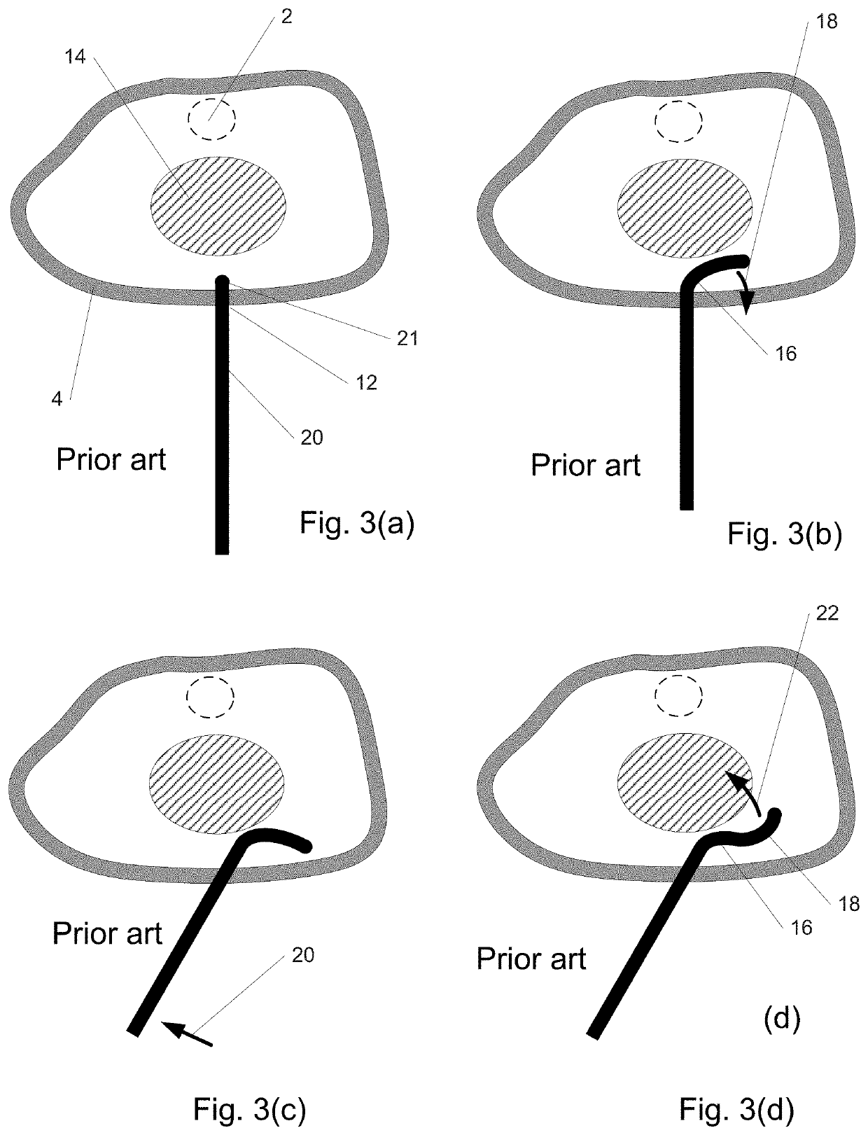 Steerable extendable devices