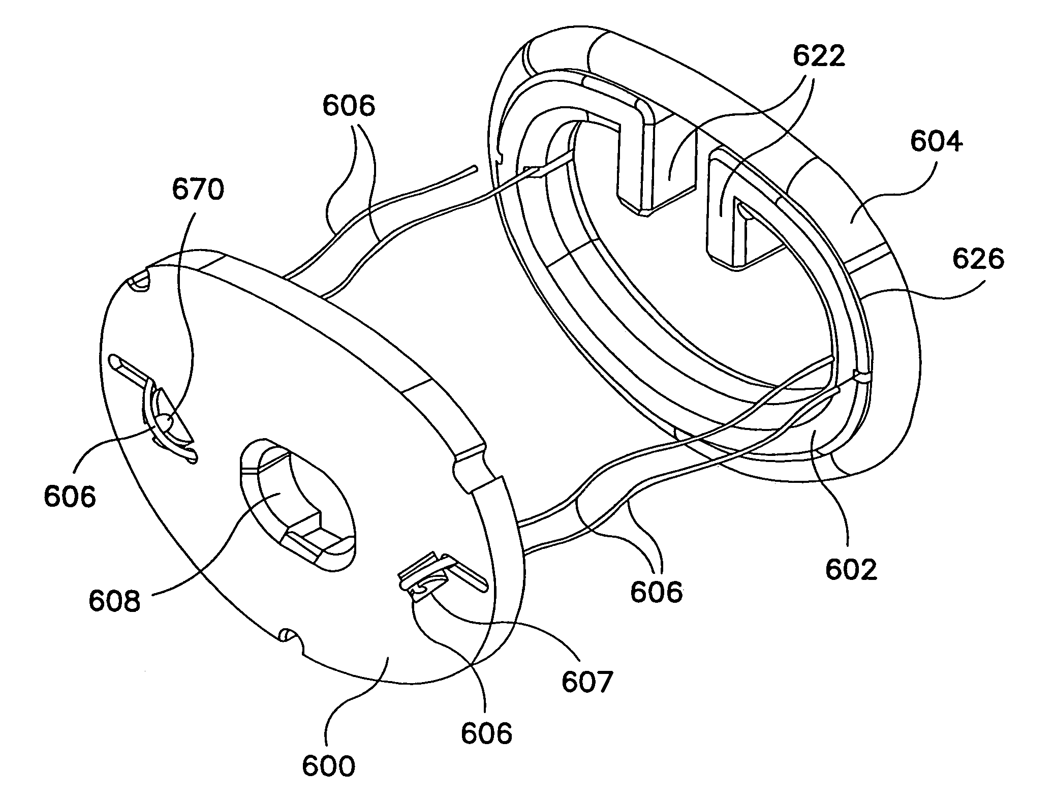 Annuloplasty system