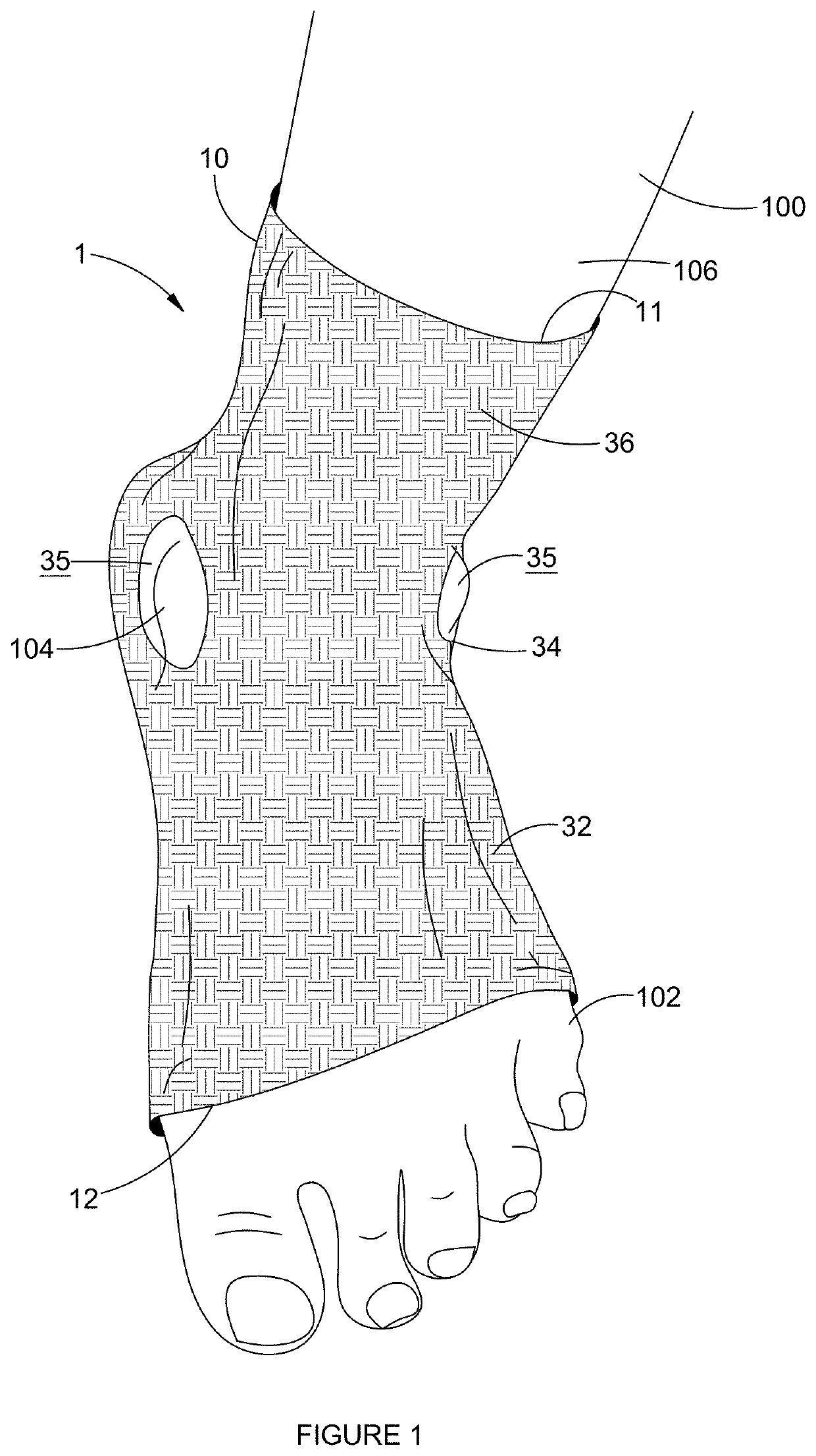 Distributive Foot Sleeve for Relieving Pressure in a Ski Boots and the Like