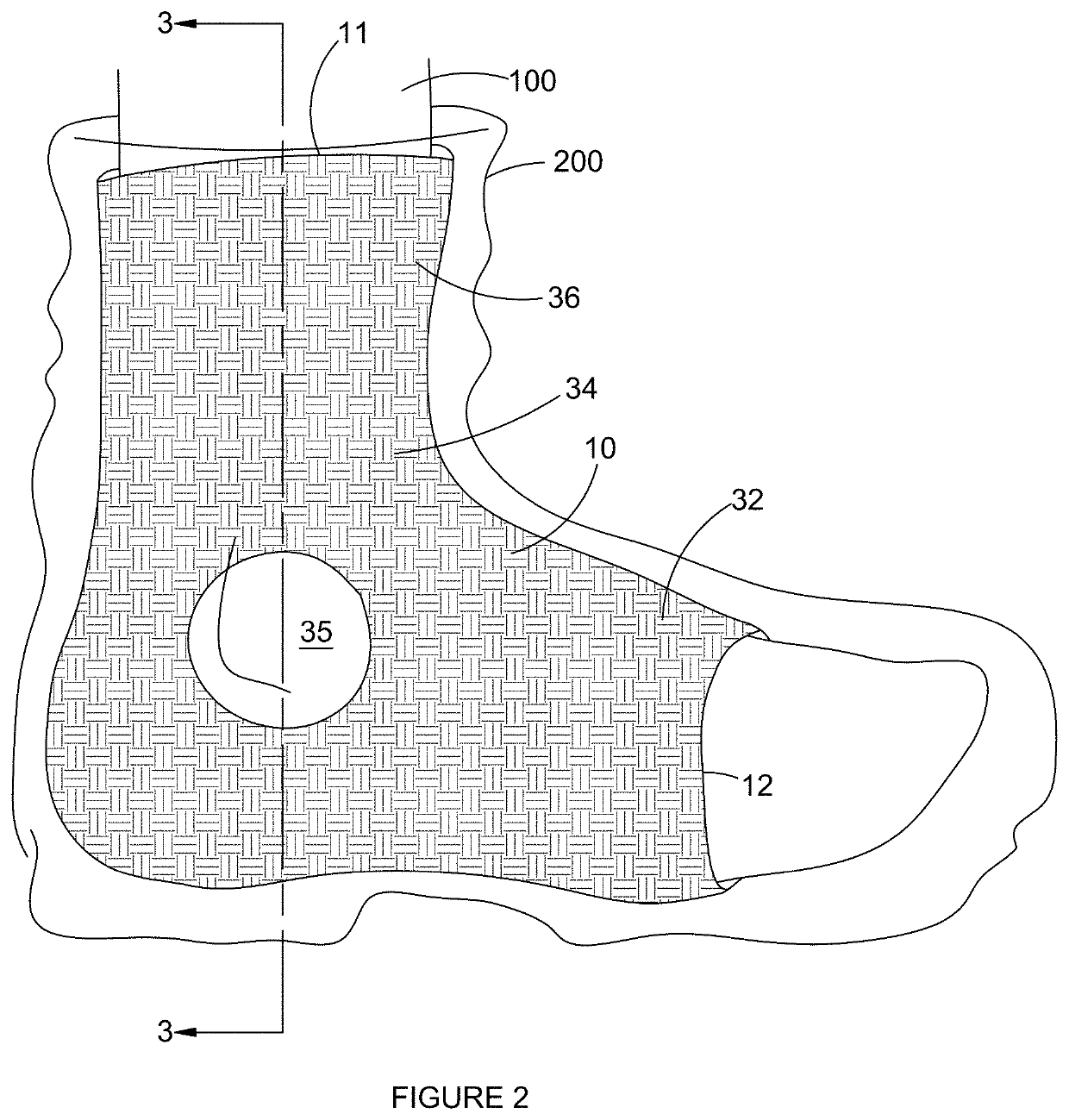 Distributive Foot Sleeve for Relieving Pressure in a Ski Boots and the Like