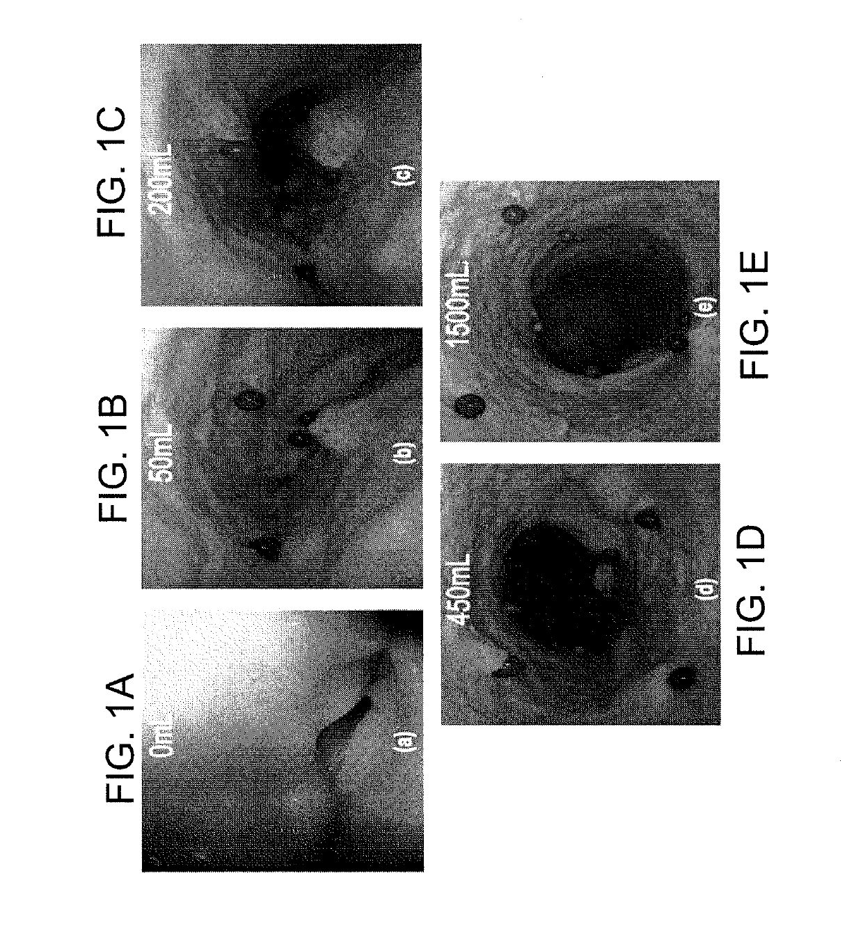 Device and method for enhanced visualization of the small intestine