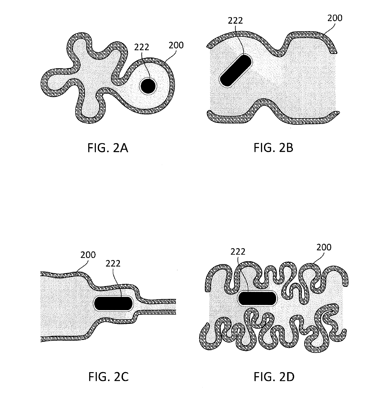 Device and method for enhanced visualization of the small intestine