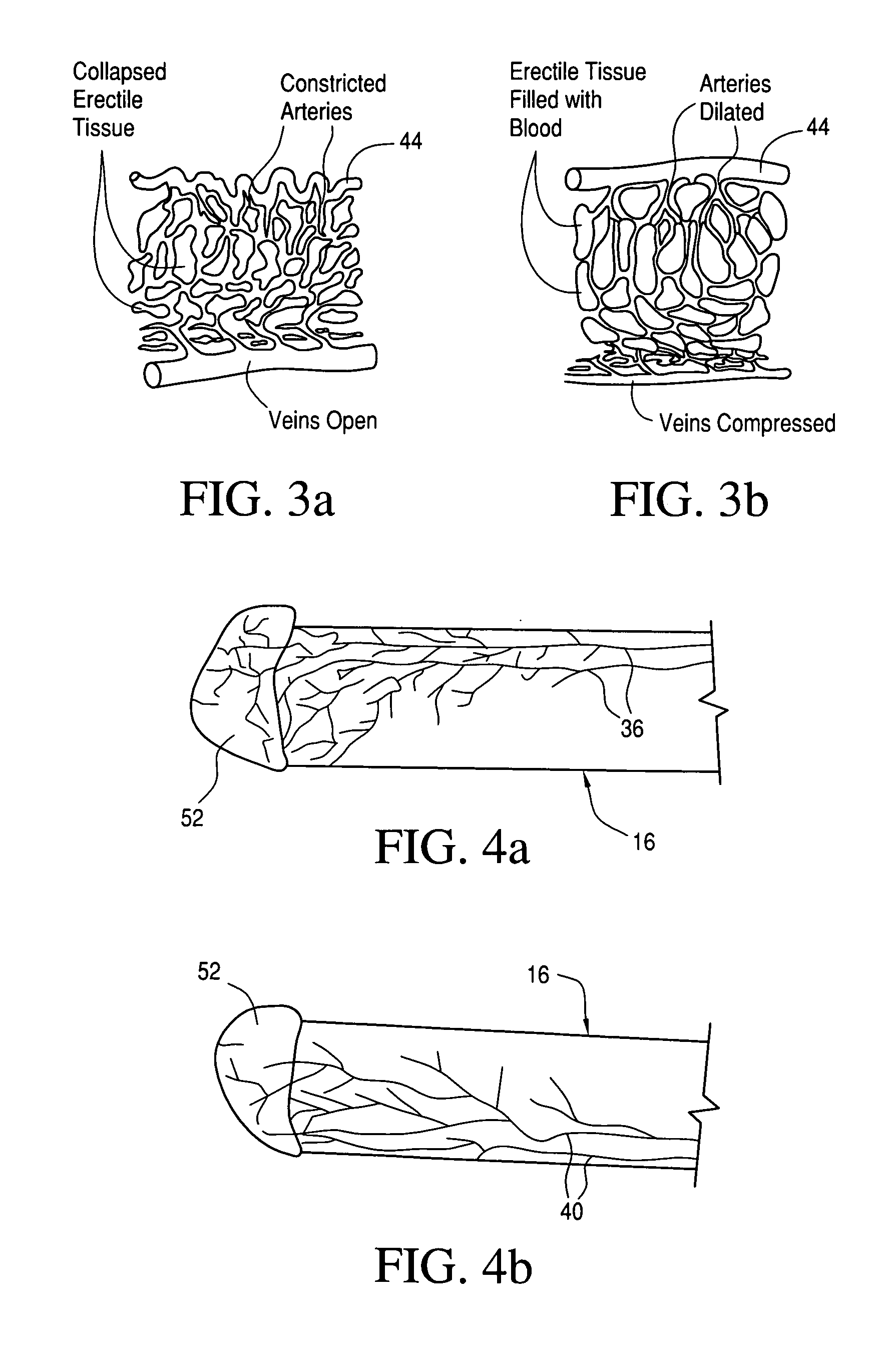 Erectile function method and device