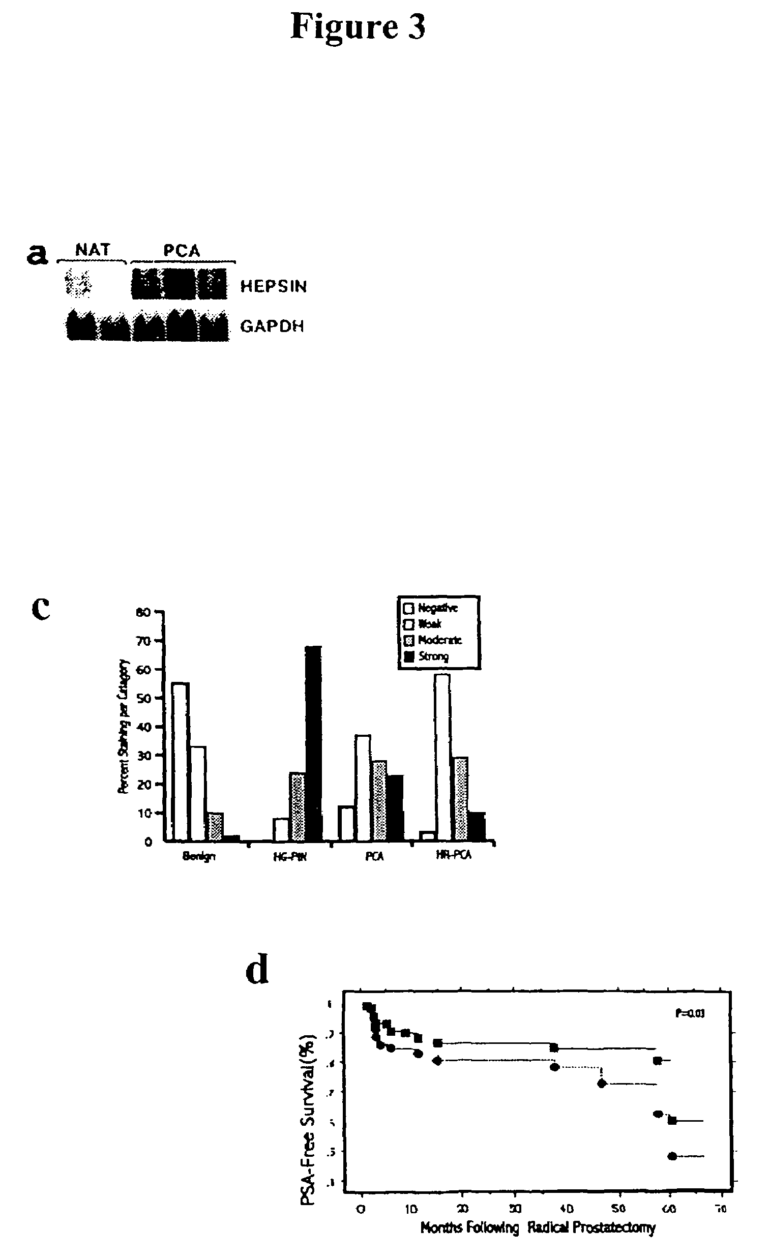 Dectection of AMACR cancer markers in urine