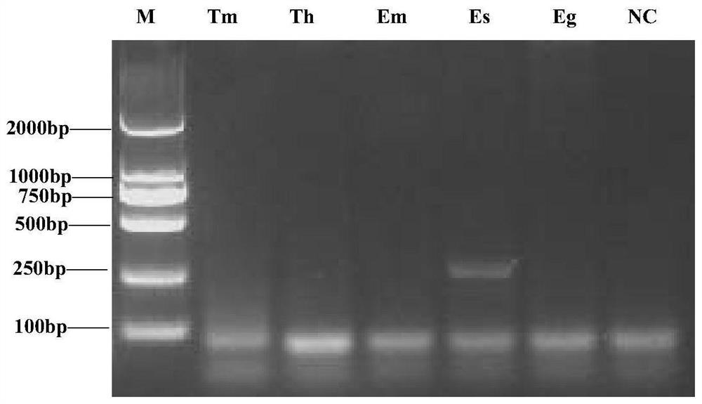 A detection kit for Echinococcus shiqu based on rpa technology and its application