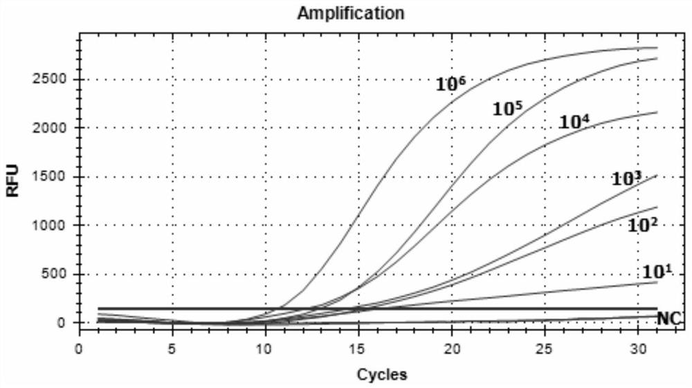 A detection kit for Echinococcus shiqu based on rpa technology and its application