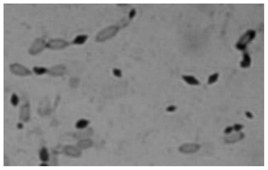 Bacillus thuringiensis and its preparation and application for controlling soybean cyst nematode and root-knot nematode incognita