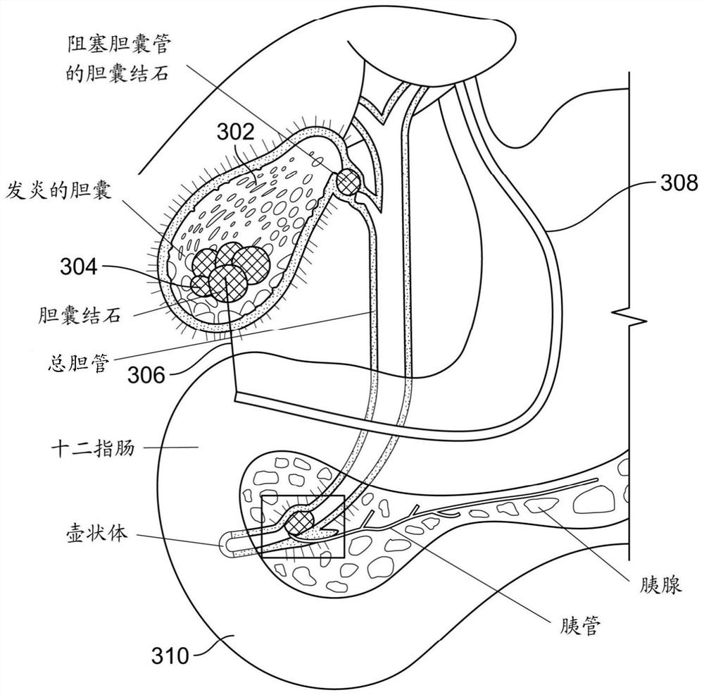 Magnetic Stapling Devices and Delivery Systems