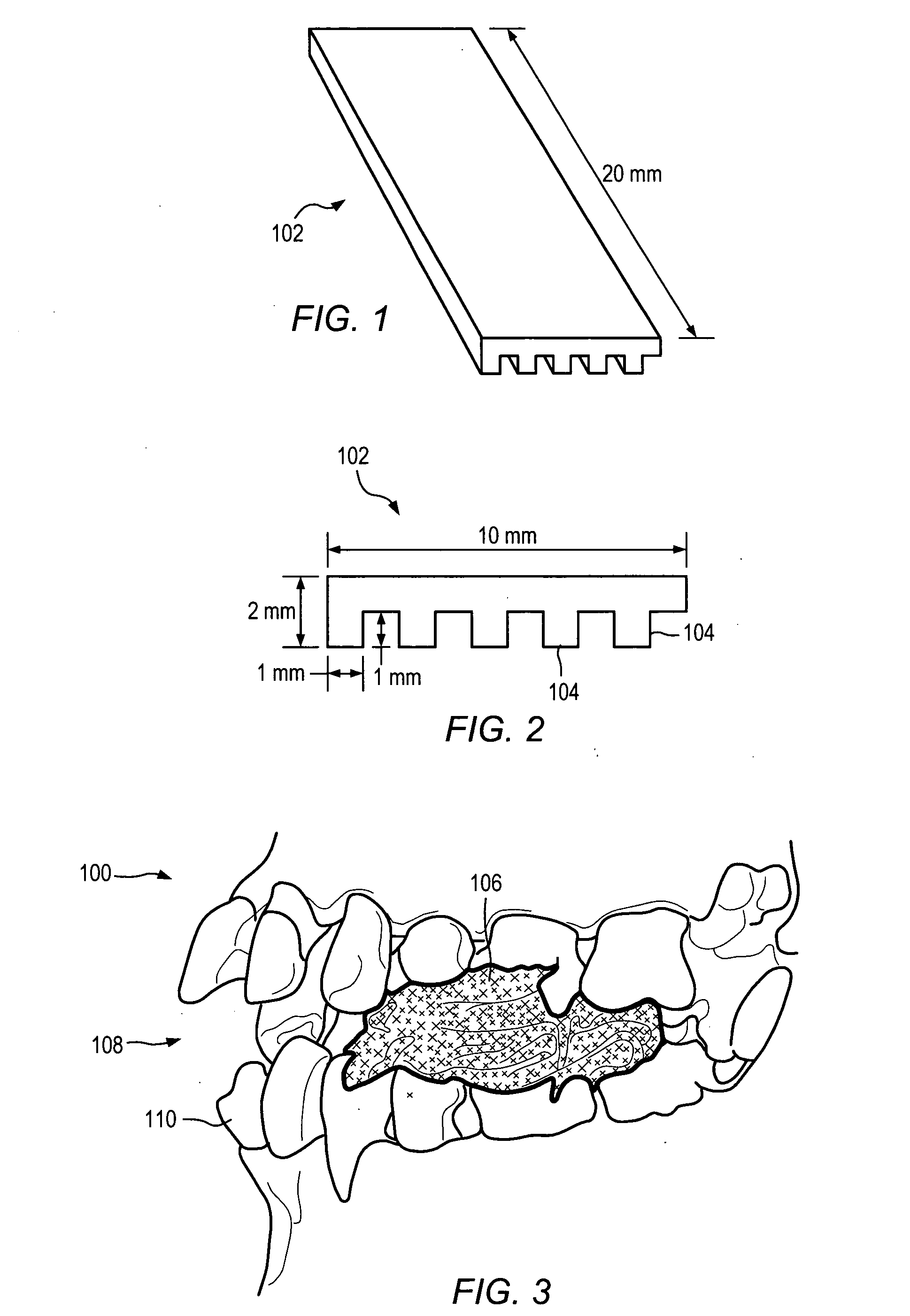 Anatomically-referenced fiducial marker for registration of data