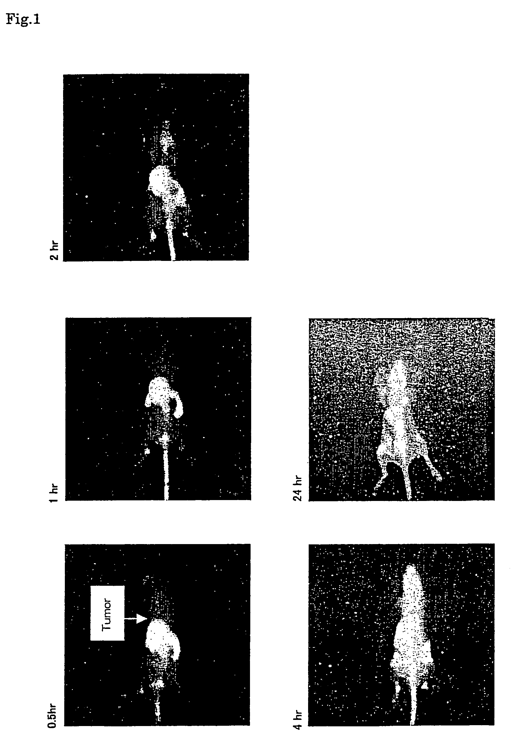 Near infrared fluorescent contrast agent and method for fluorescence imaging