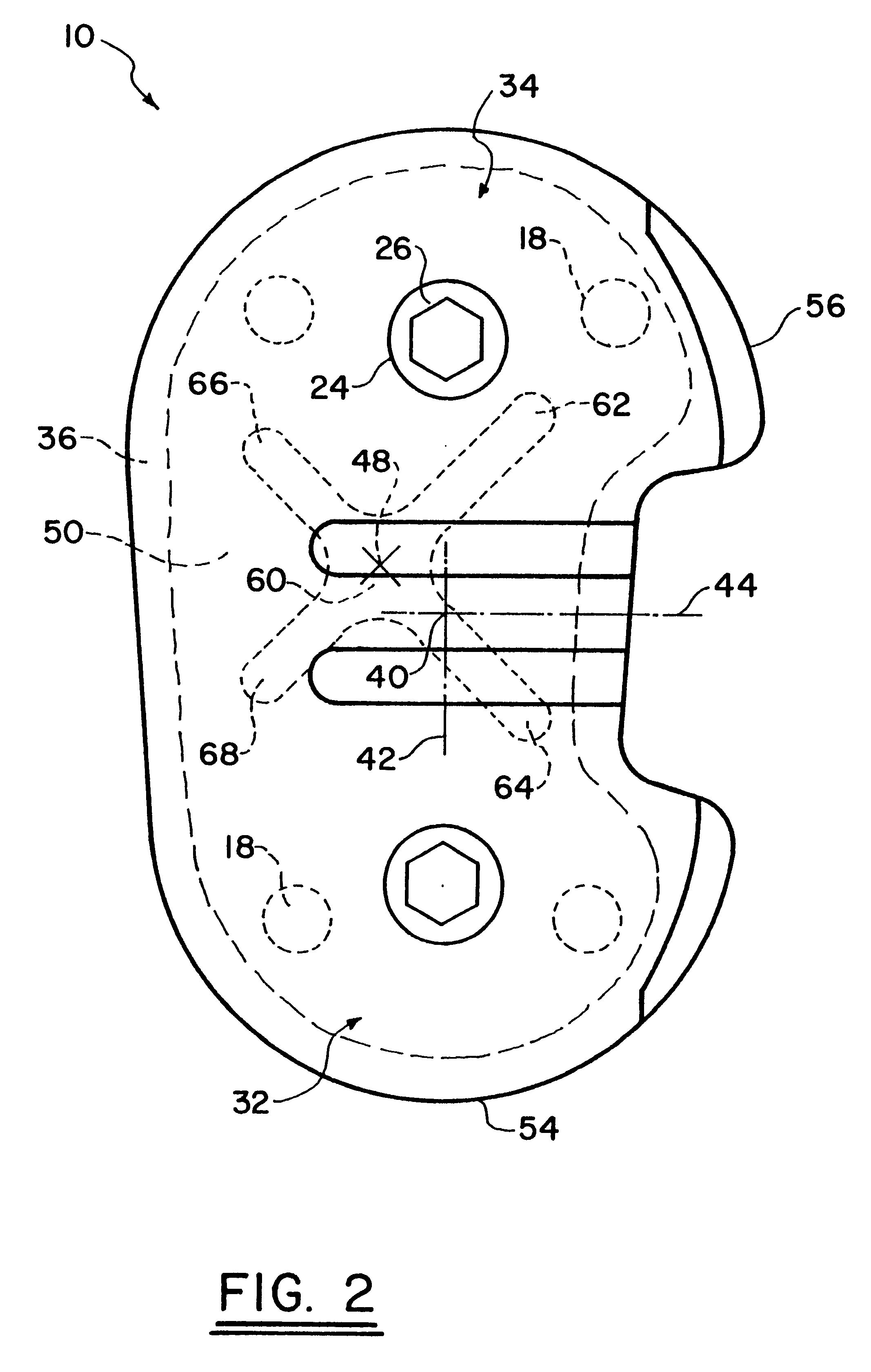 Tibial prosthetic implant with offset stem