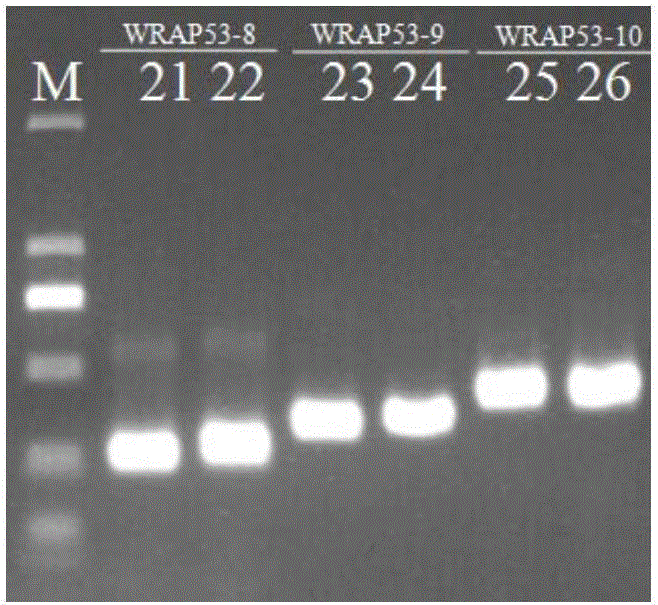 Primer for detecting WRAP53 gene mutation and application of primer