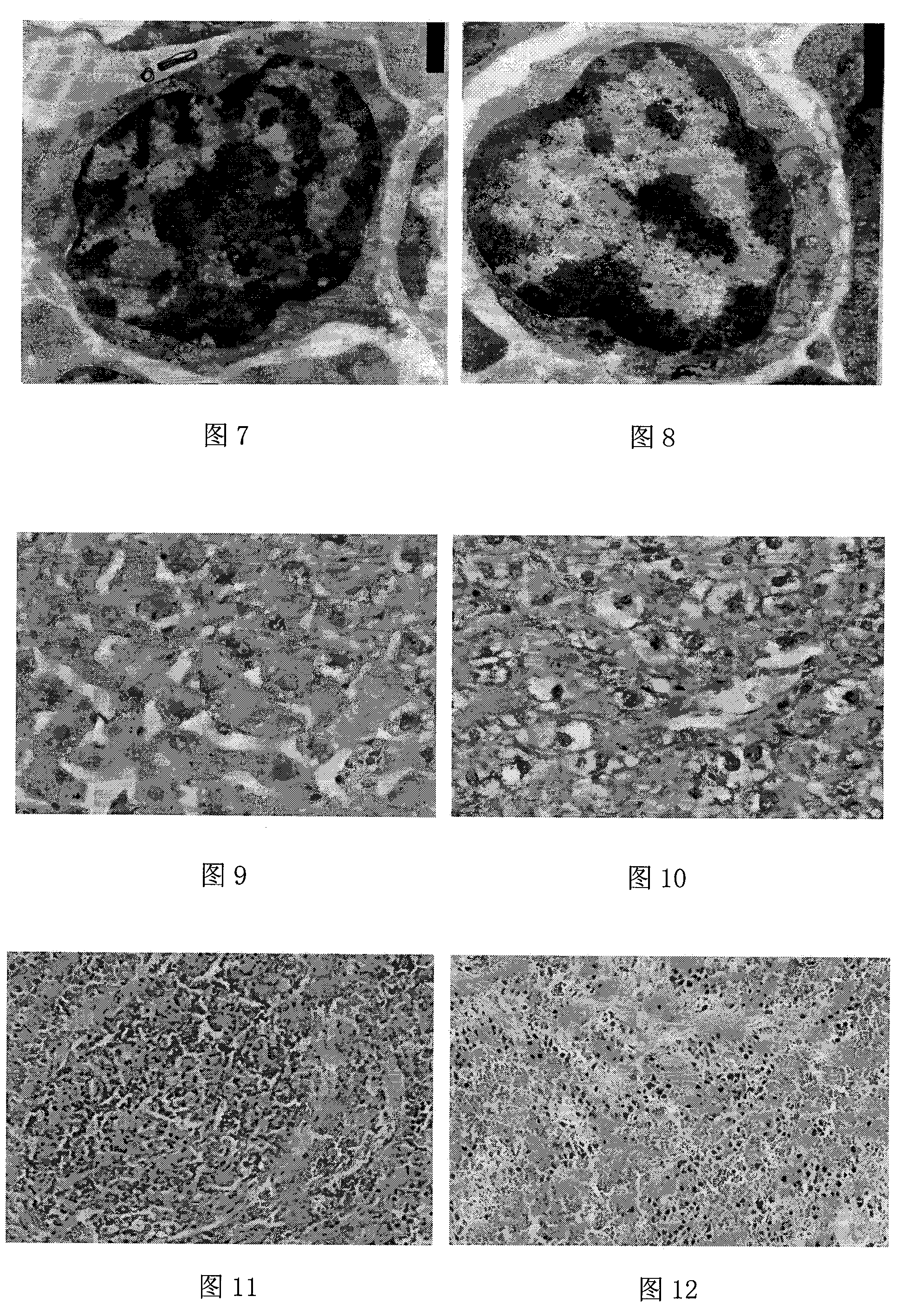 Nutritive composition for accelerating hemopoietic stem cell proliferation and hemoglobin synthesis