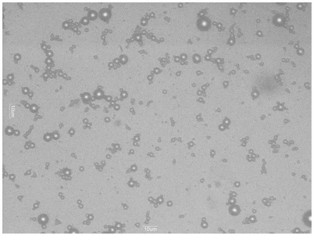 A kind of ultrasonic contrast agent and preparation method thereof