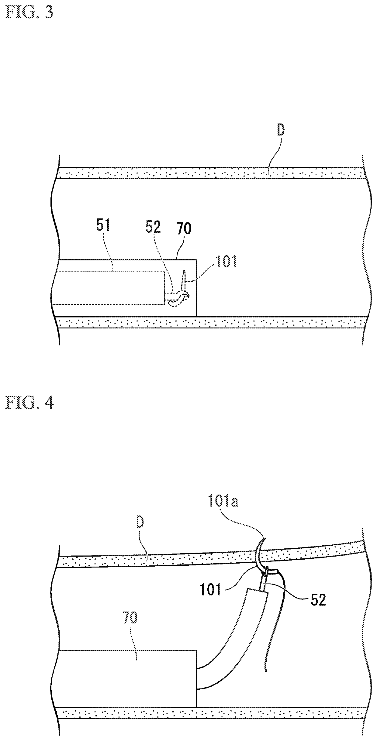 Method of delivering and recovering curved needle