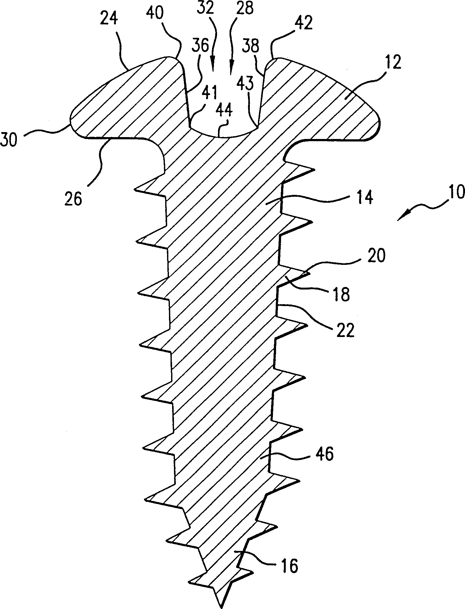 Locally heat-treated and hardened screw