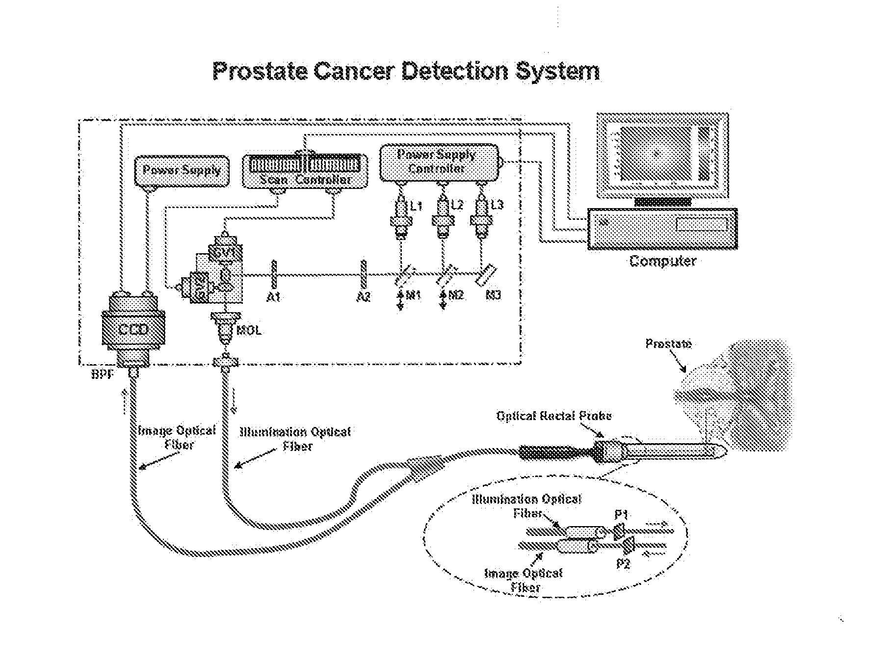 Near infrared photonic prostatoscopy analyzer