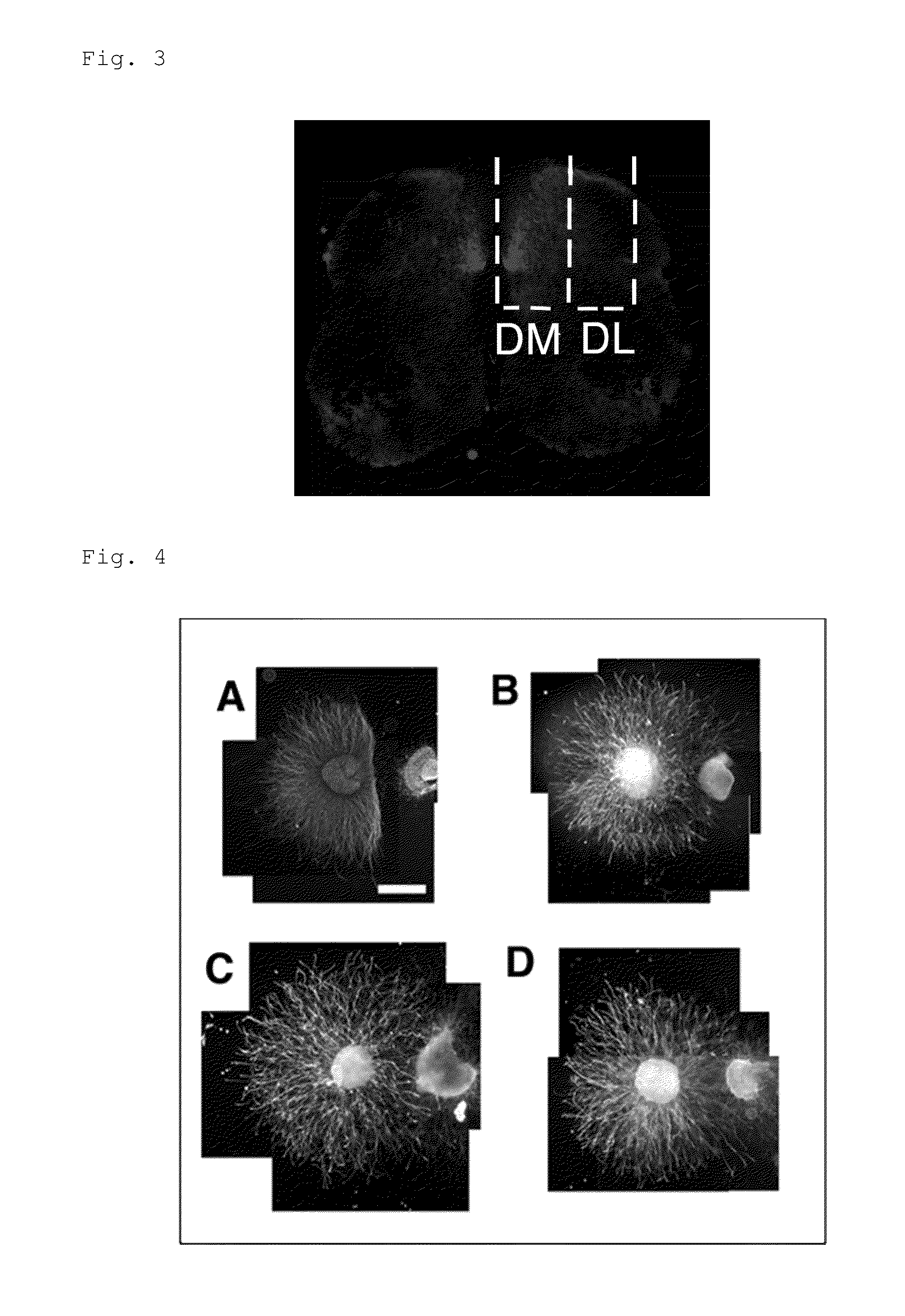 Antibody binding to lysophosphatidylglucoside, and composition comprising the same
