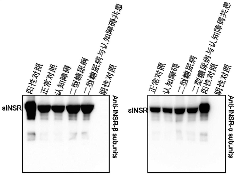 Soluble insulin receptor as type 2 diabetes detection biomarker