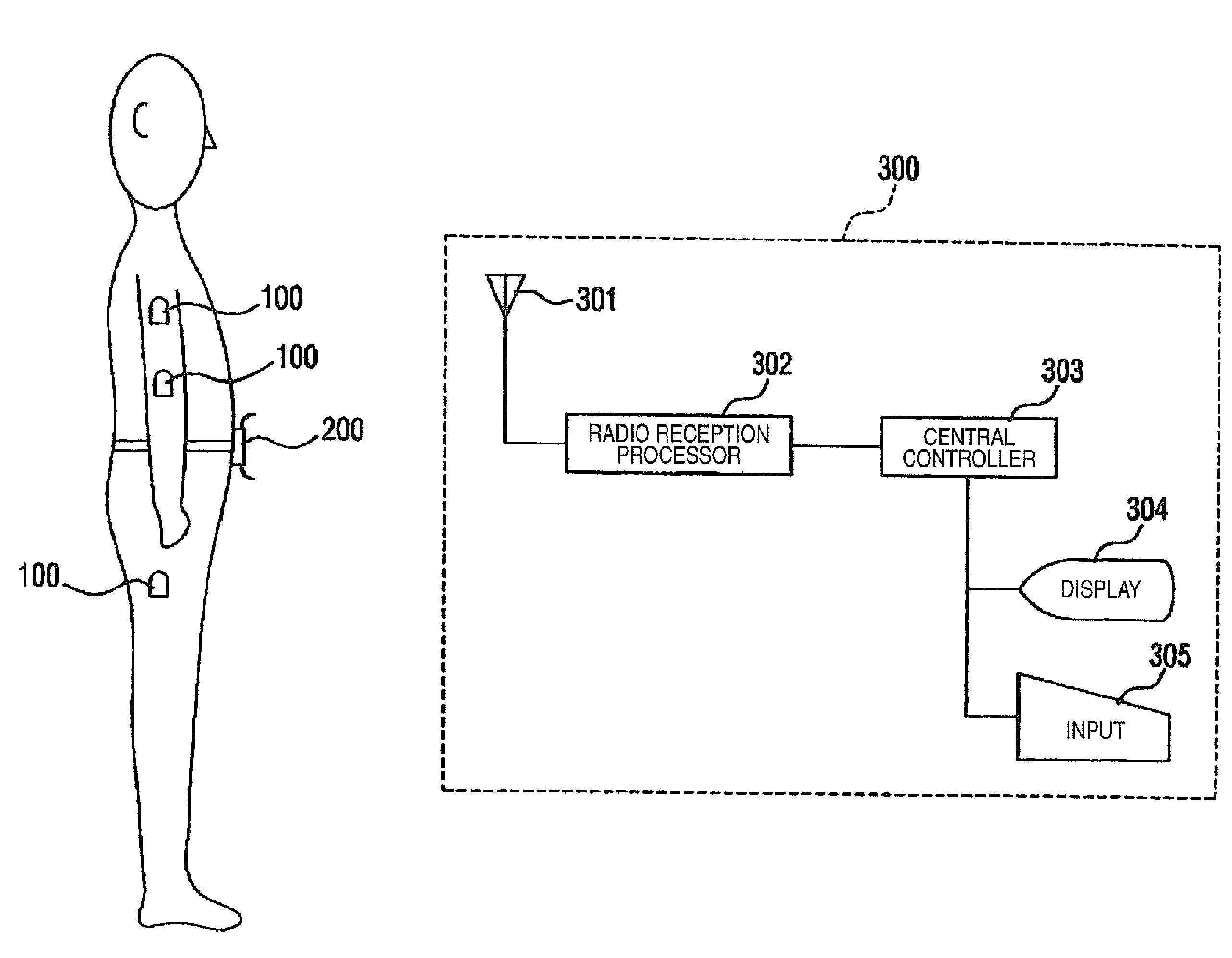 Biological Information Acquisition Telemetry System