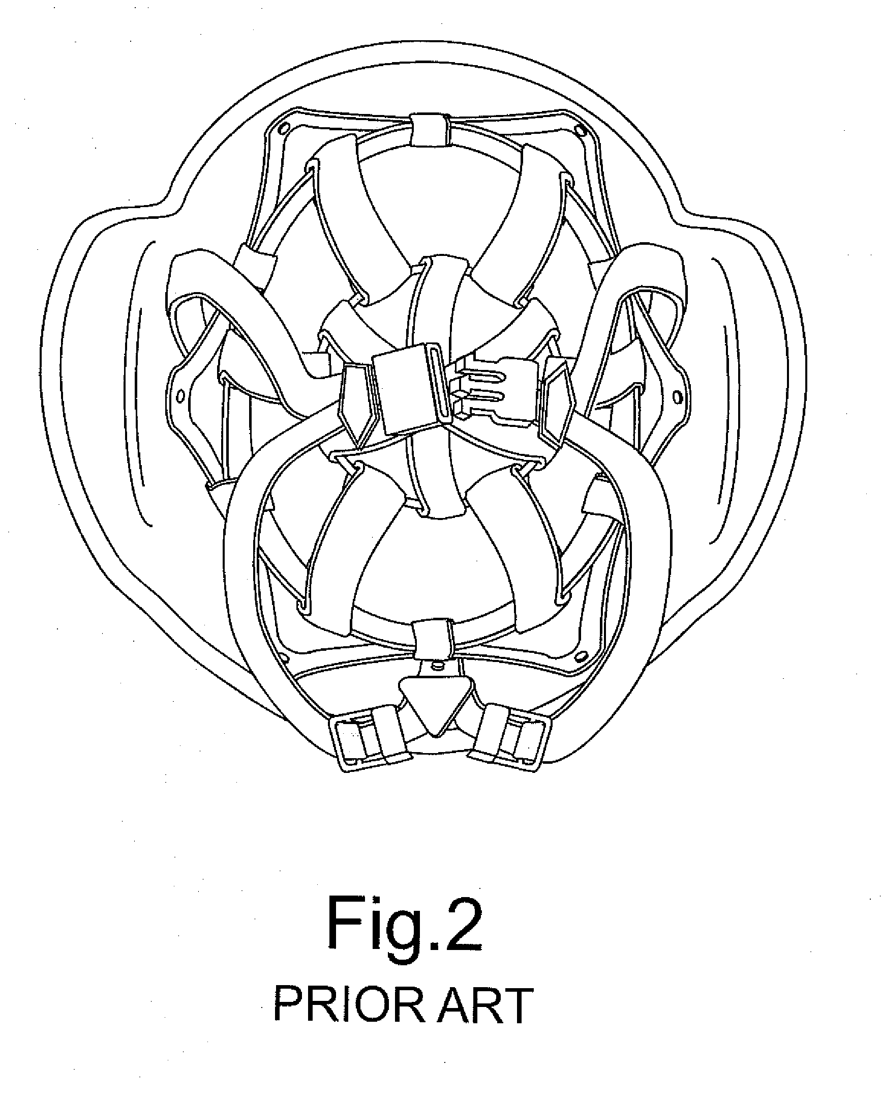 Helmet fitting and impact attenuation system