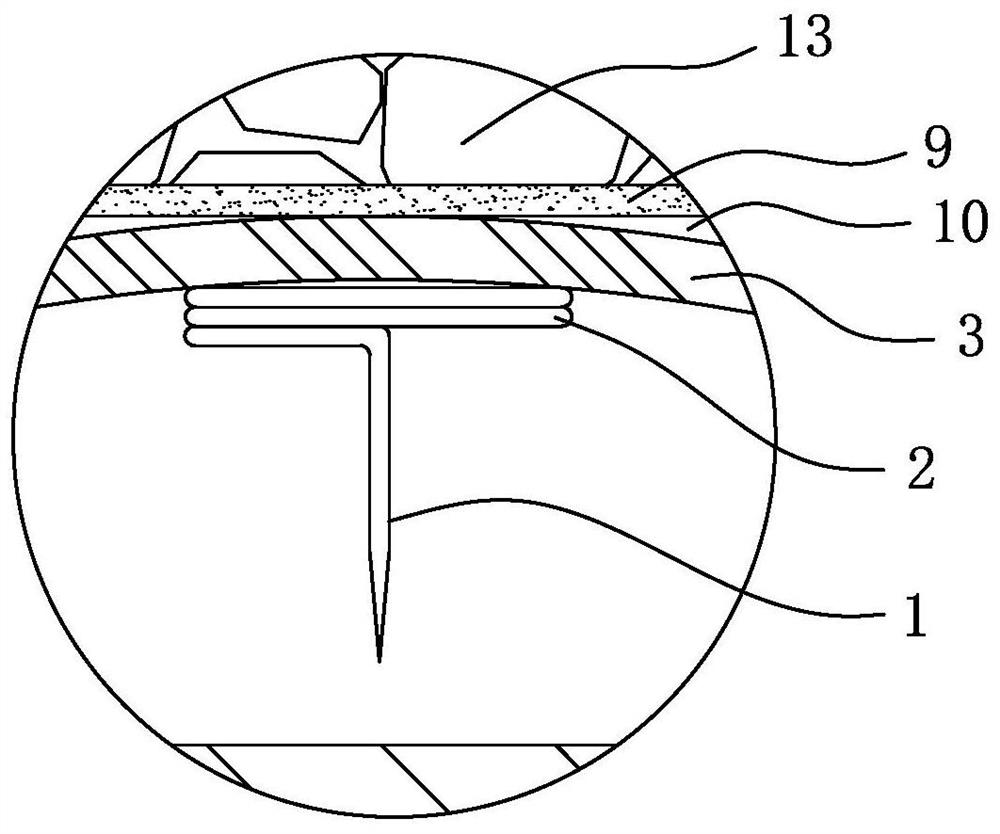 Direct-pressing thumb-tack needle