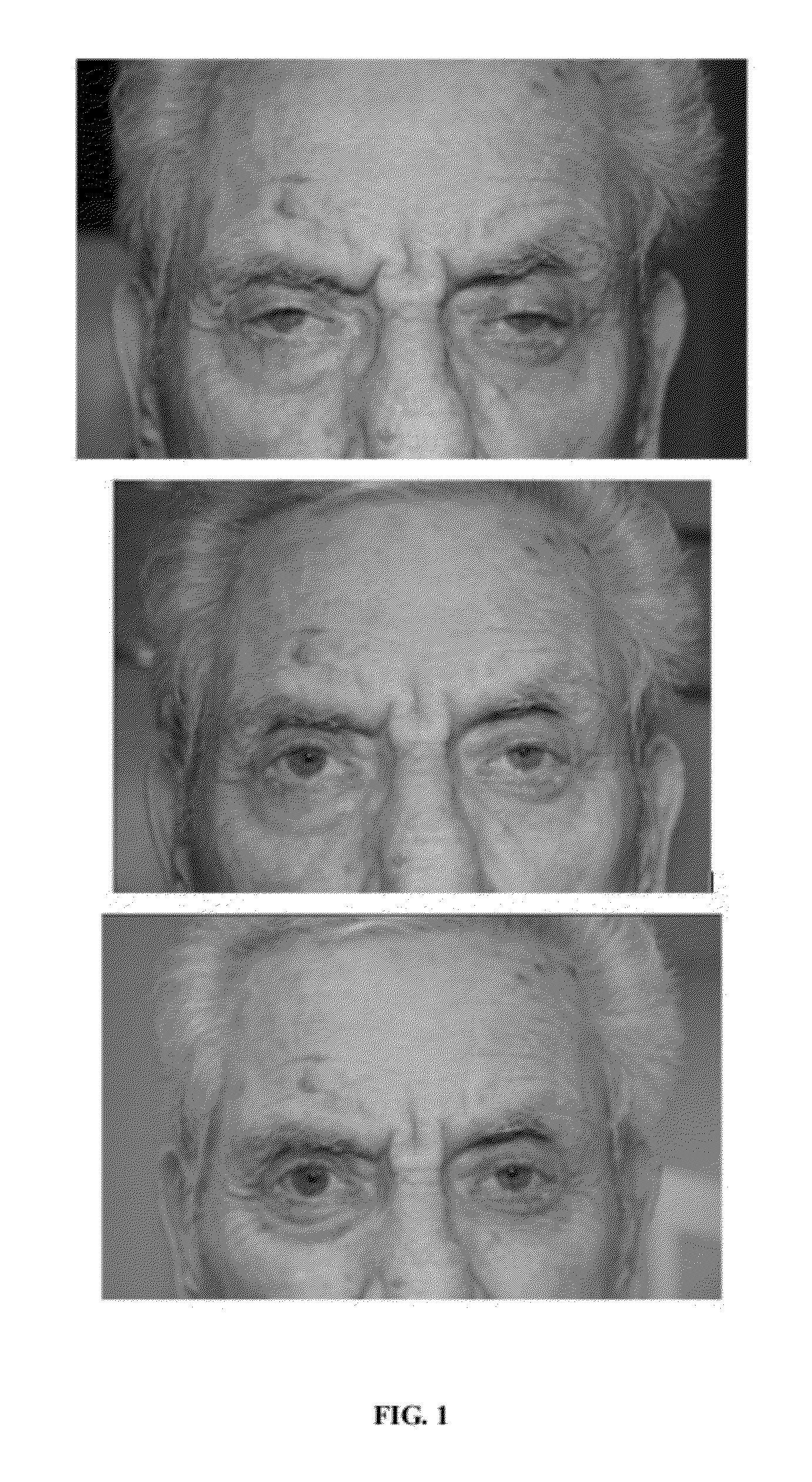 Compositions and methods for non-surgical treatment of ptosis