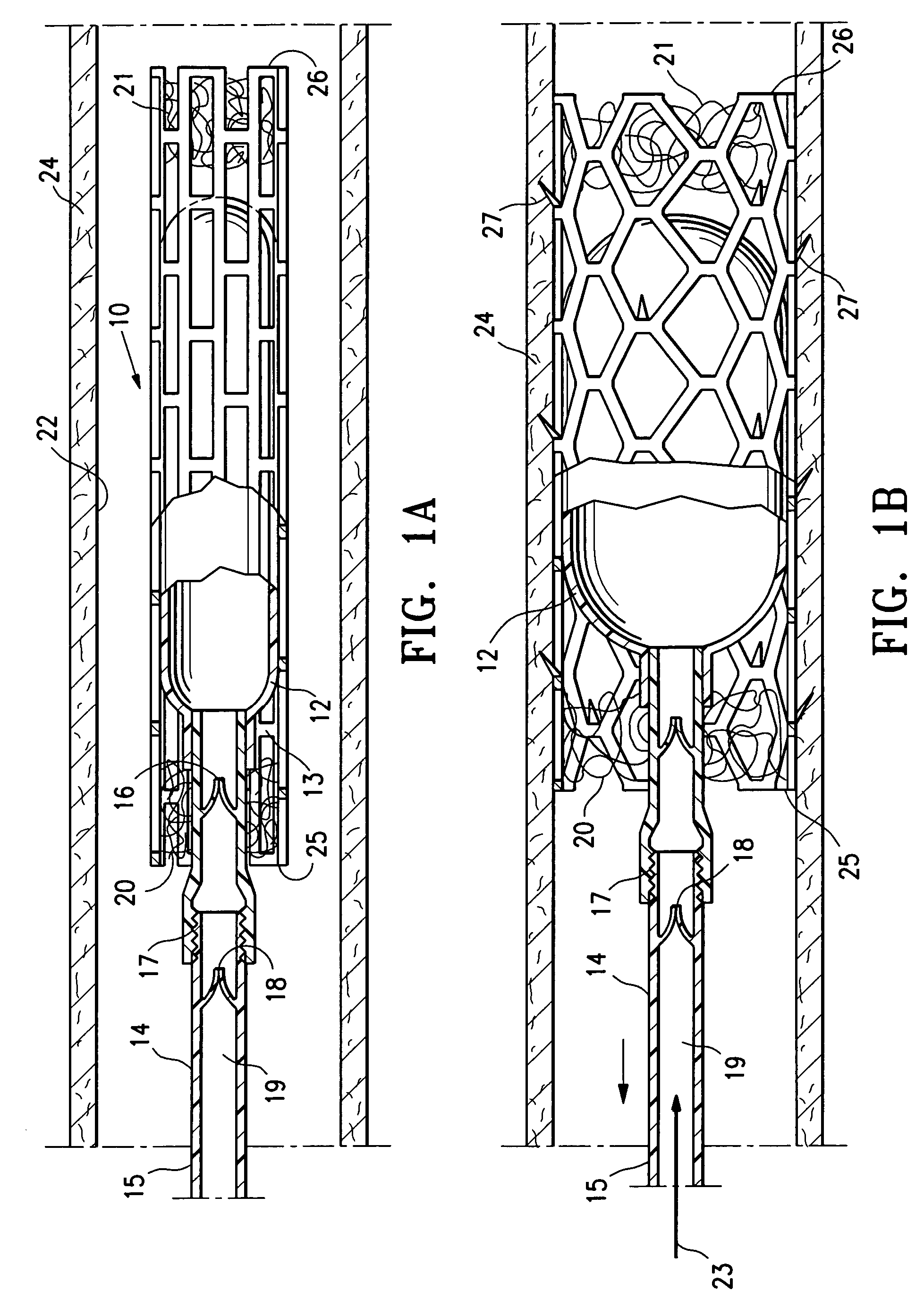 Contraceptive with permeable and impermeable components