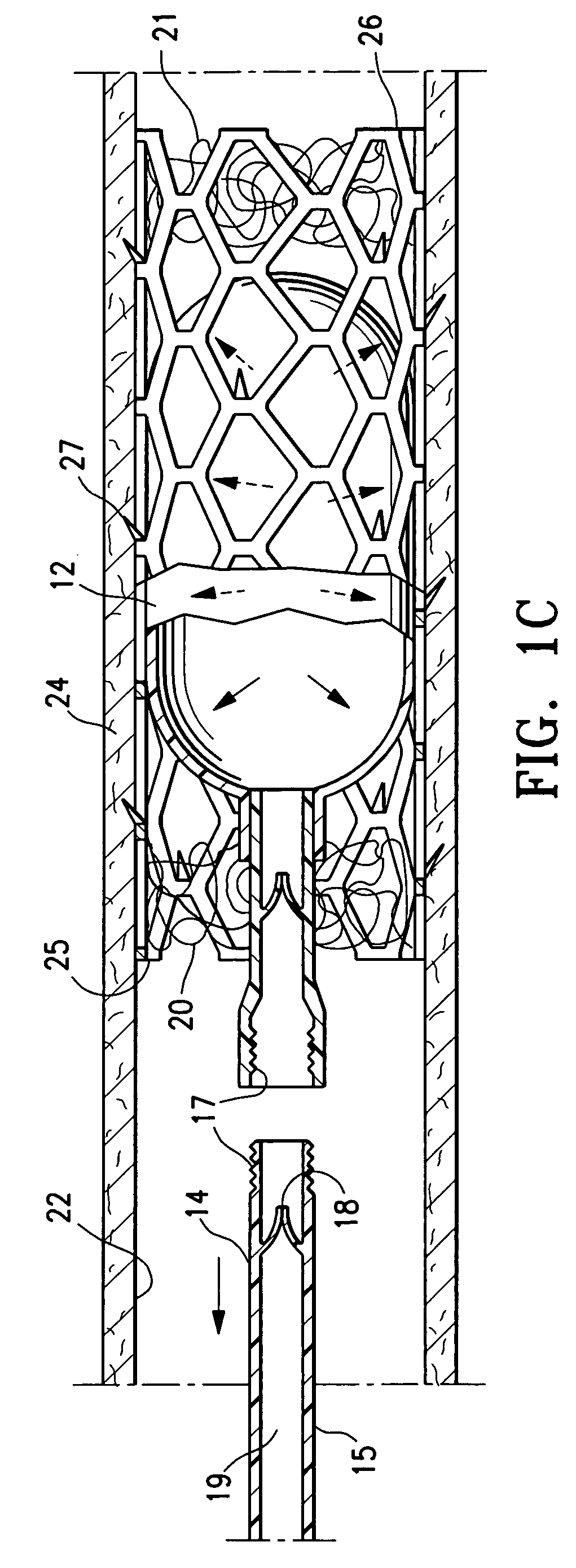 Contraceptive with permeable and impermeable components