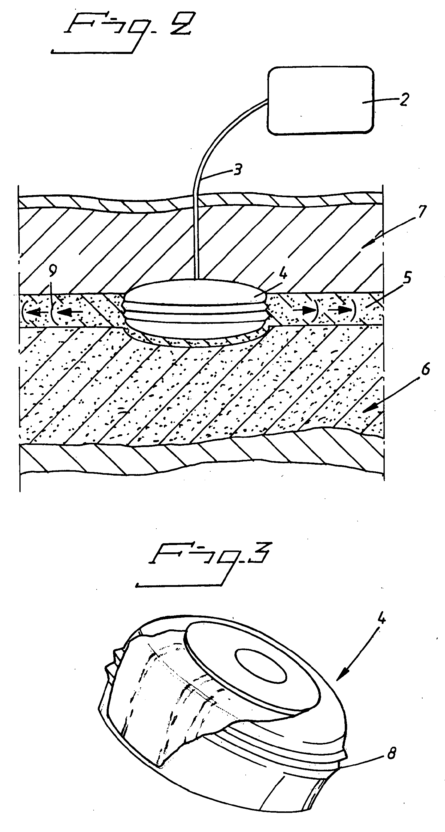Vibrator for bone conducting hearing devices