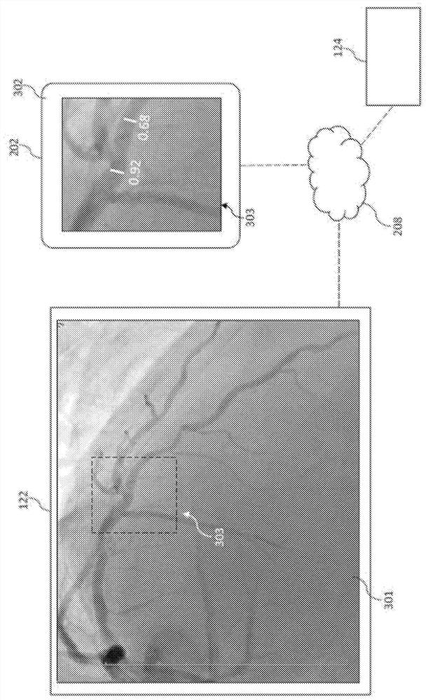 Bedside Interface for Percutaneous Coronary Intervention Planning
