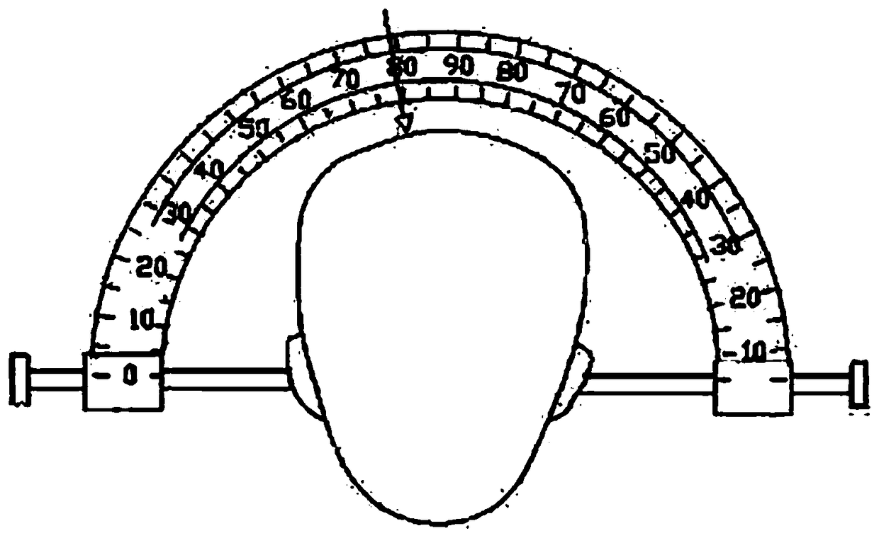 A lateral ventricle frontal horn puncture guiding device