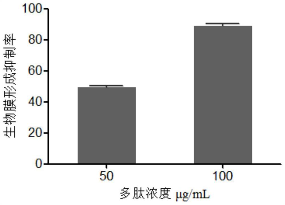 A kind of anti-candida albicans polypeptide and its application