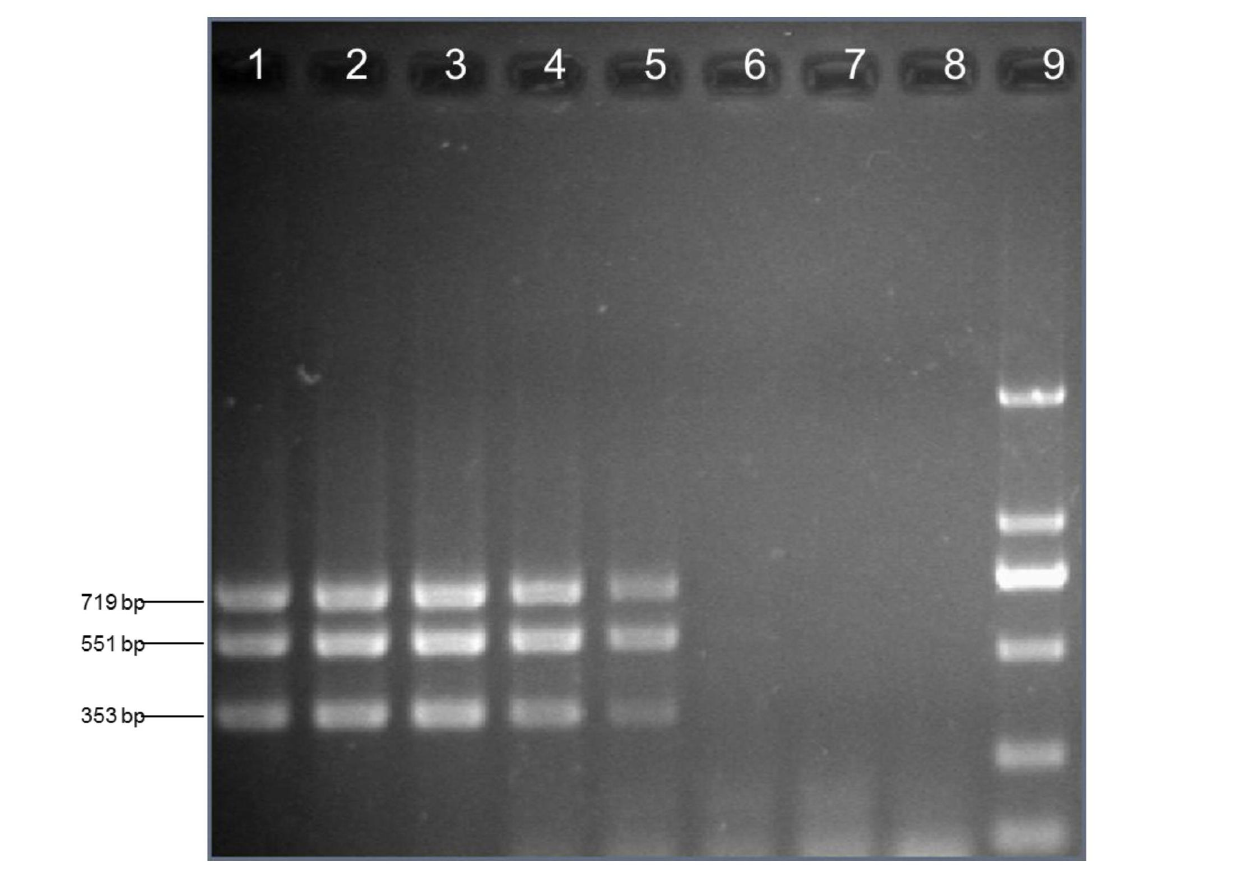 Multiple touchdown PCR (polymerase chain reaction) detection kit of acinetobacter baumannii
