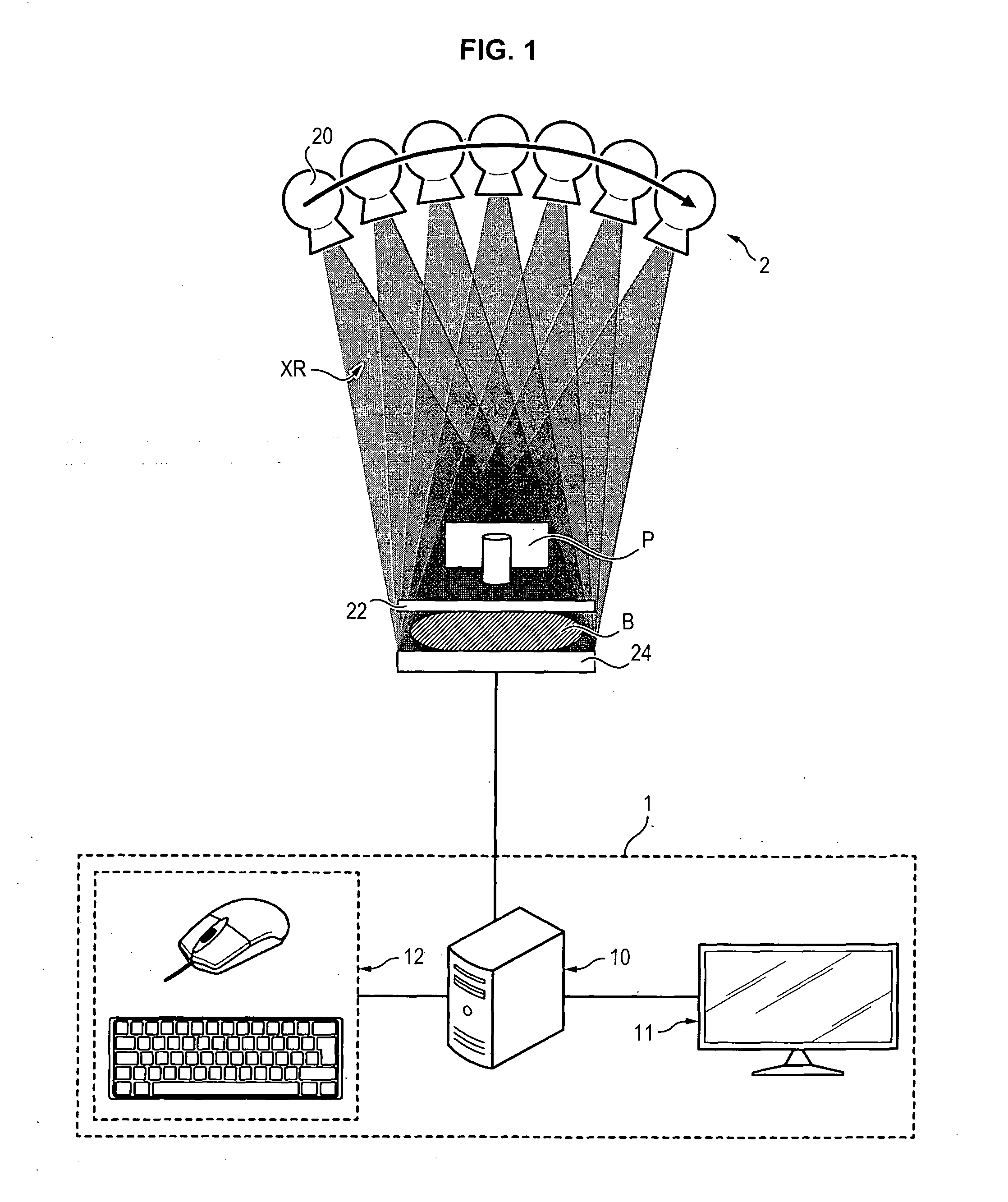 Method of processing x-ray images of a breast