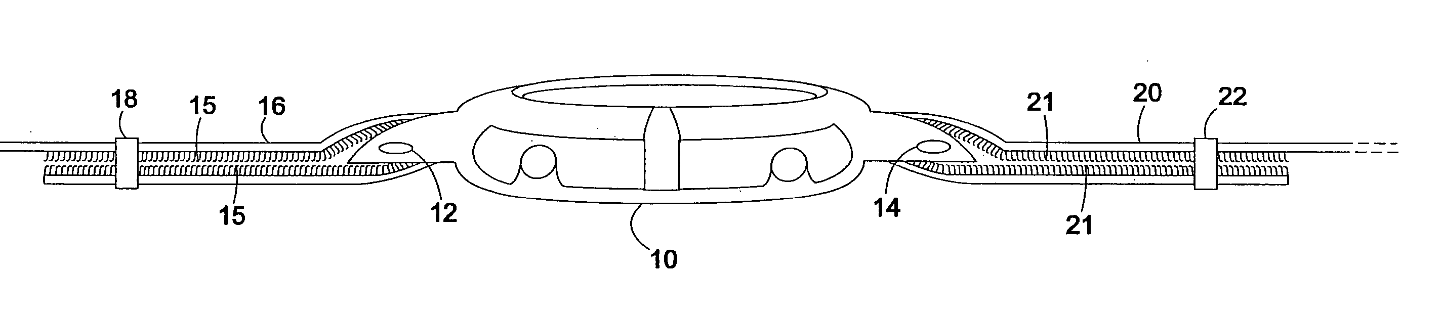 Quick-change watchbands