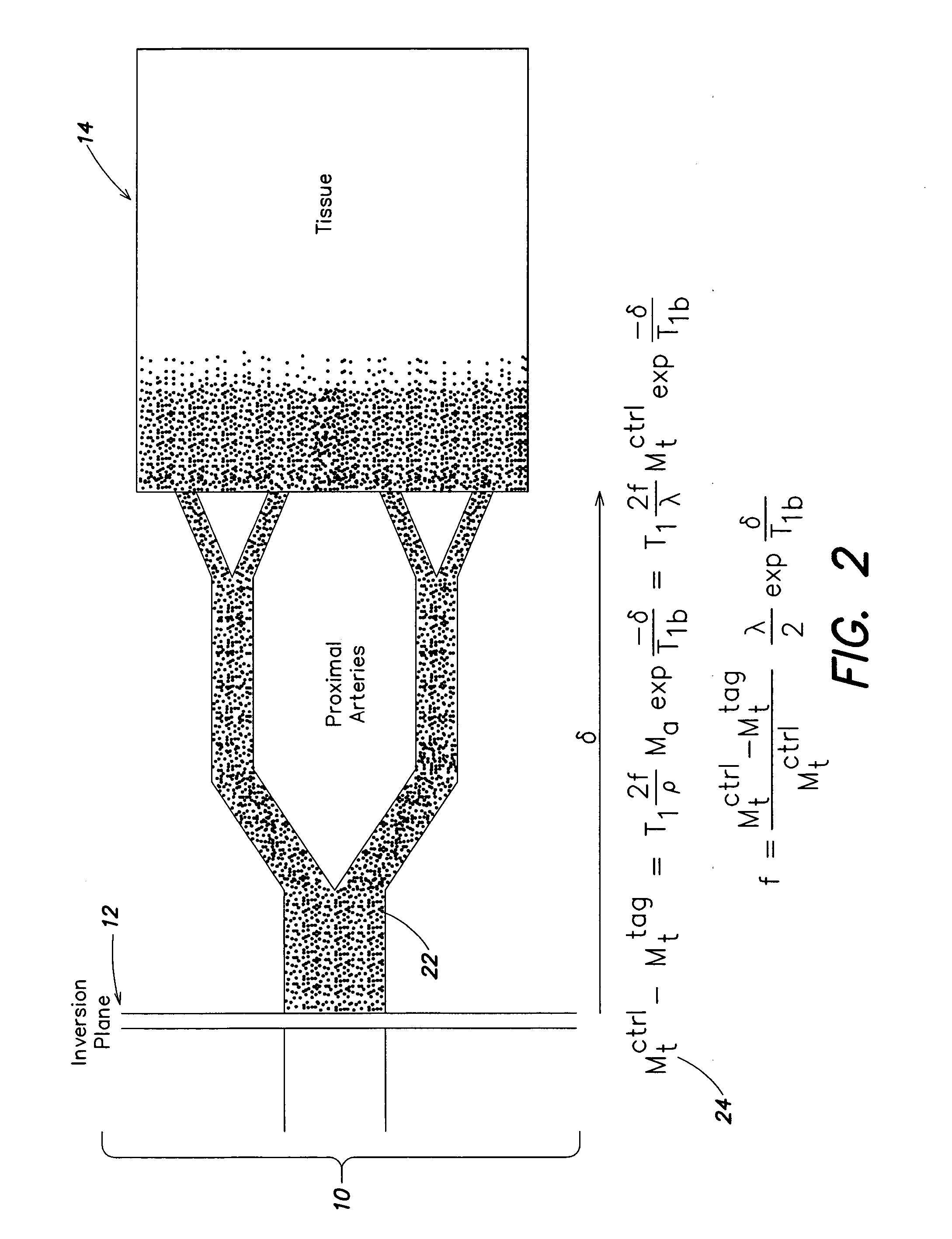 Arterial spin labeling using time varying gradients