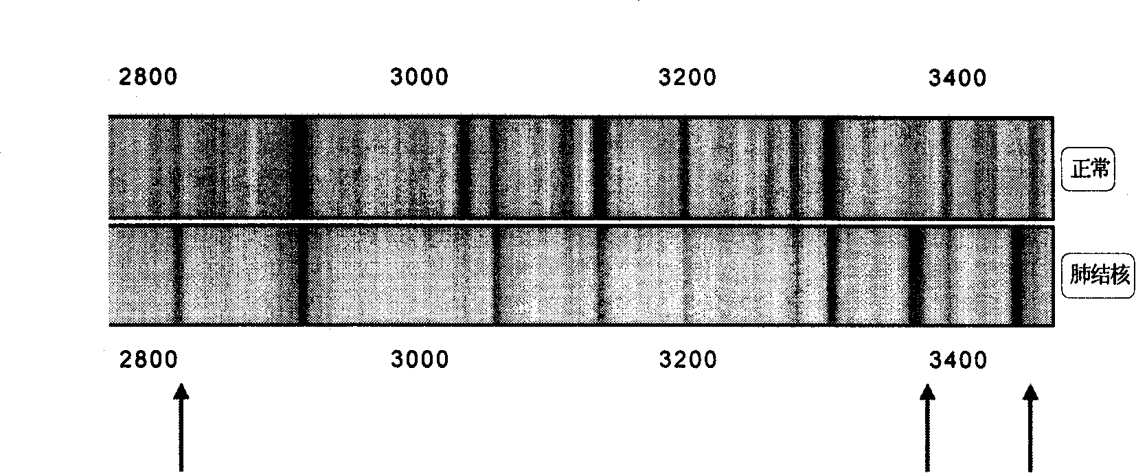 Mass spectrometry reagent kit and method for rapid tuberculosis diagnosis