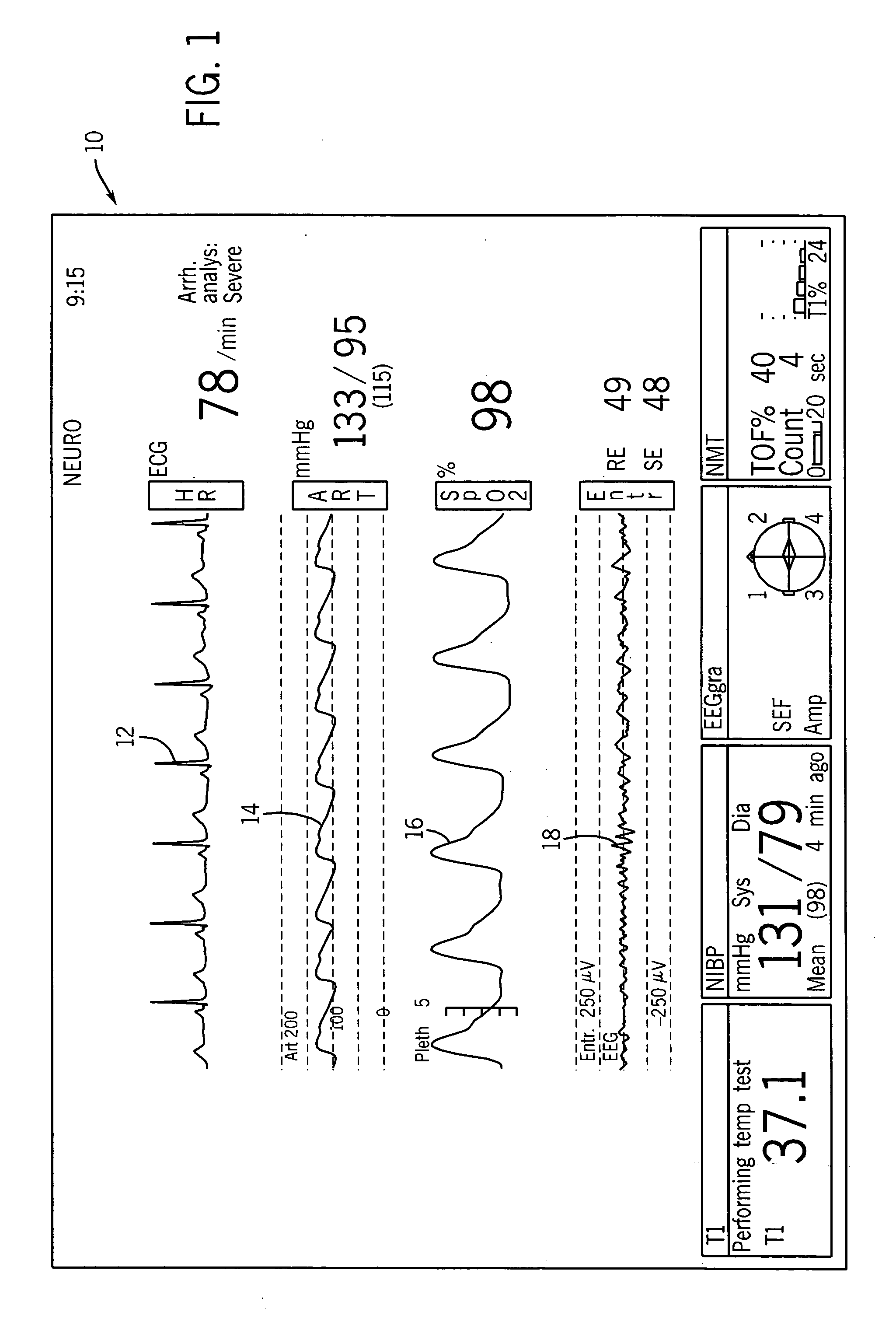 Integrated anesthesia monitoring and ultrasound display