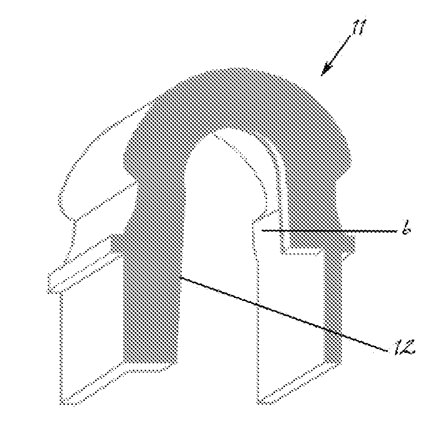 Precision attachment system with indirect retainer