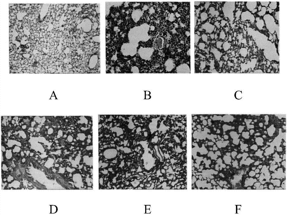 Pharmaceutical composition for treating asthma