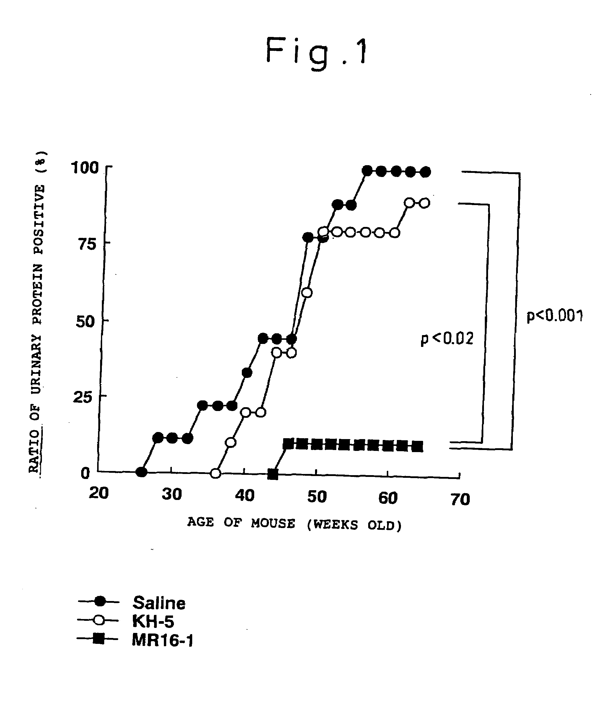 Preventive and/or therapeutic method for systemic lupus erythematosus comprising anti-IL-6 receptor antibody administration