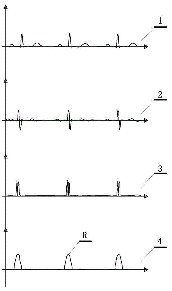 Method for handheld electrocardio detector to automatically start electrocardiogram recording