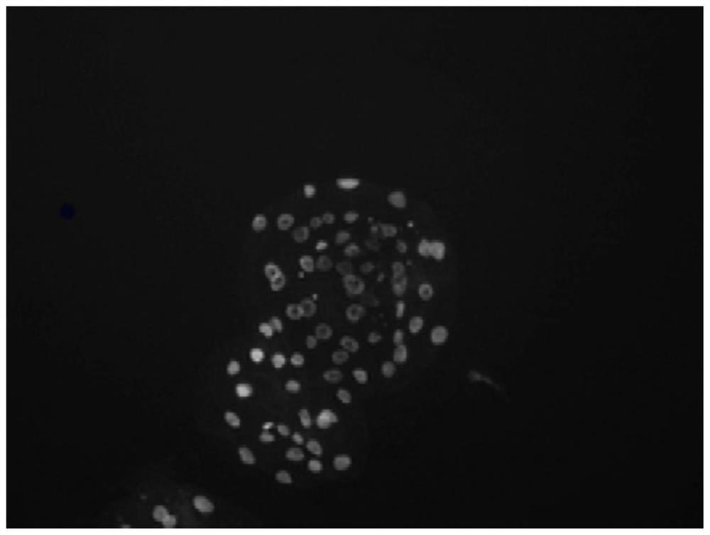 Pig oocyte maturation medium in vitro and its application